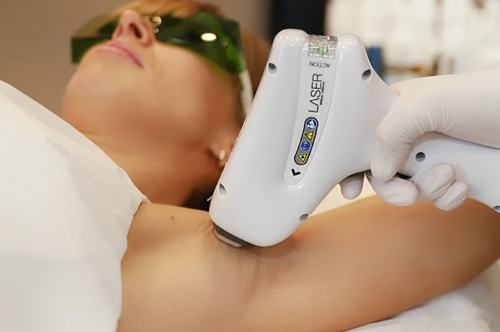 2-how-to-prepare-for-laser-hair-removal