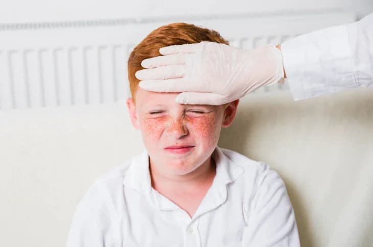 Bērnam izsitumi: kad noteikti jāvēršas pie dermatologa?