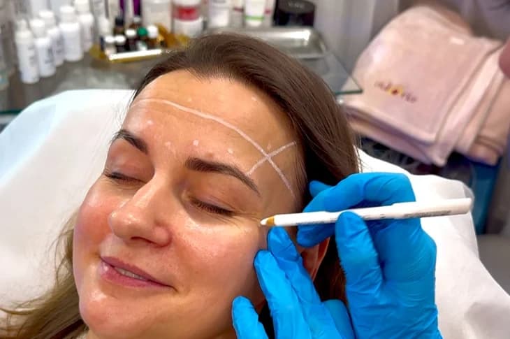 How to prepare for a botulinum toxin injection procedure?