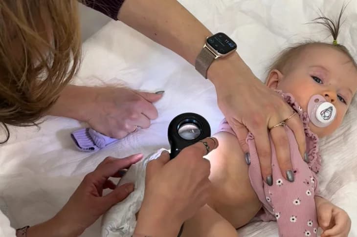Bērnam izsitumi: kad noteikti jāvēršas pie dermatologa?