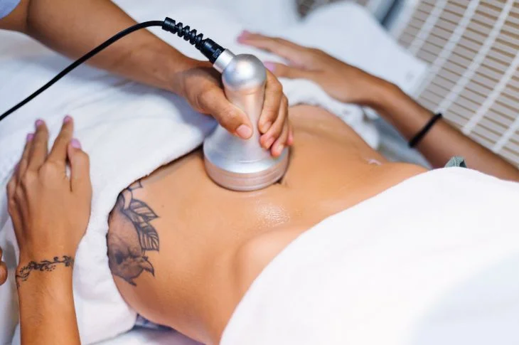 What is ultrasound liposuction or cavitation?