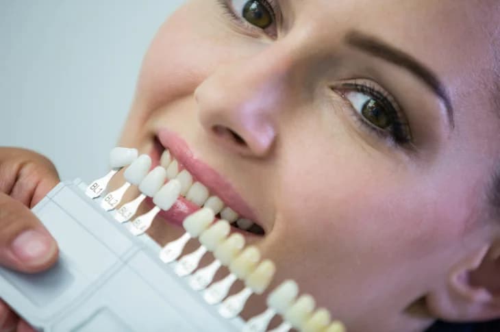 Learn How Effective Professional Teeth Whitening!